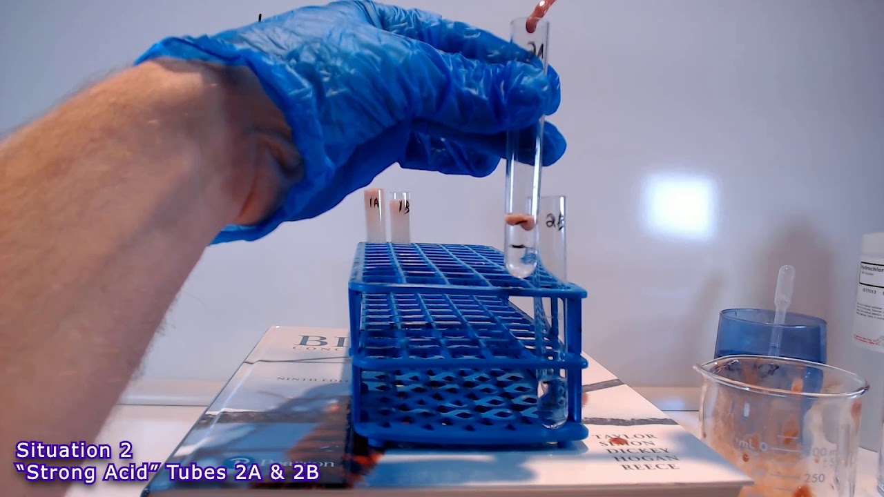 Catalase Activity Lab