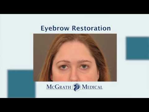 Eyebrow Hair Restoration | McGrath Medical | Austin TX