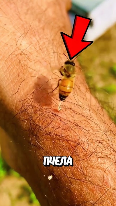 Что Делать Если Укусила Пчела? 🤯 - YouTube