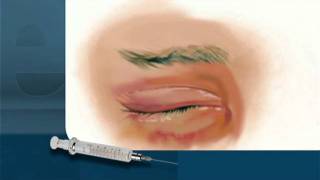 Botox Injections by Unlicensed Practitioners screenshot 4
