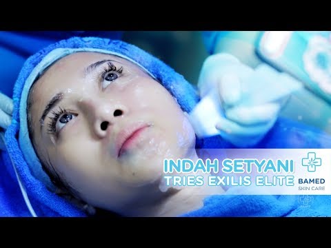 Indah Setyani Tries Exilis Elite | Bamed Skin Care