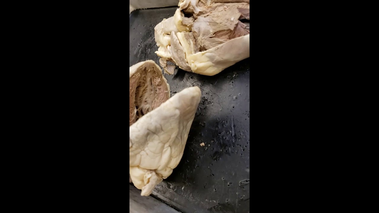 Heart Dissection Walkthrough YouTube