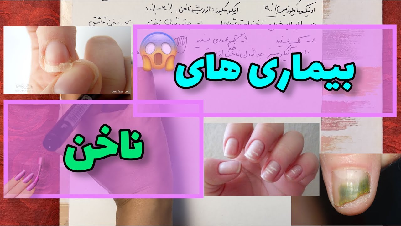 آموزش کاشت ناخن |بیماری های ناخن 😱Nail Disorders