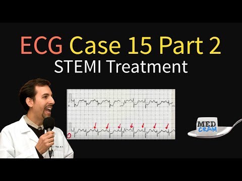 stemi-/-acs-treatment---ecg-interpretation-case-15-(part-2)