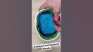What’s the difference between Subdural and epidural bleeds? #paramedic #paramedicstudent #emtstudent