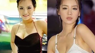 top 10 beautiful korean plastic surgery before and after