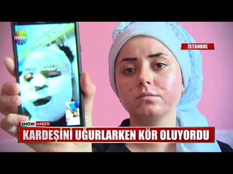 Kardeşini Uğurlarken Kör Oluyordu