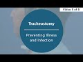 Caring for Your Tracheostomy - Preventing Illness and Infection [Part 5 of 8]