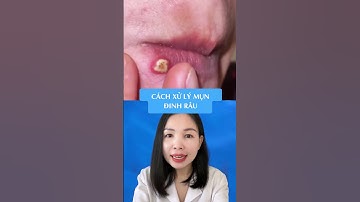 Mụn đinh râu #bacsithuha #shots