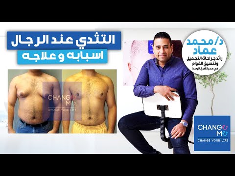 التثدي - دكتور زد تثدى الرجال فى مصر