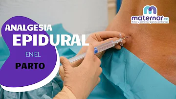 ¿Cuáles son las desventajas de la epidural?