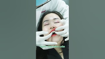 "Âm thầm niềng răng" với khay trong suốt Invisalign tại Nha Khoa Đăng Lưu