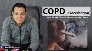 COPD exacerbation / الانسداد الرئوي المزمن - في الطوارئ او قسم الباطنة