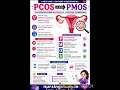 PCOS IS NOW PMOS  #medicaleducation #nursingstudent #internationallyeducatednurse #nursing