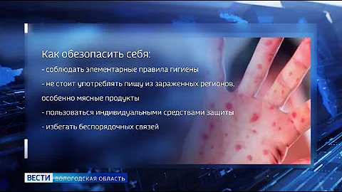 Вологжанам: как обезопасить себя от обезьяньей оспы