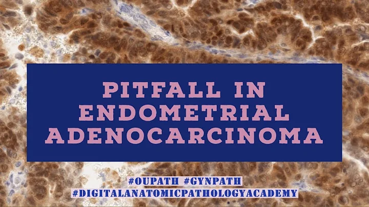 Pitfall in Diagnosis of Endometrial Adenocarcinomas