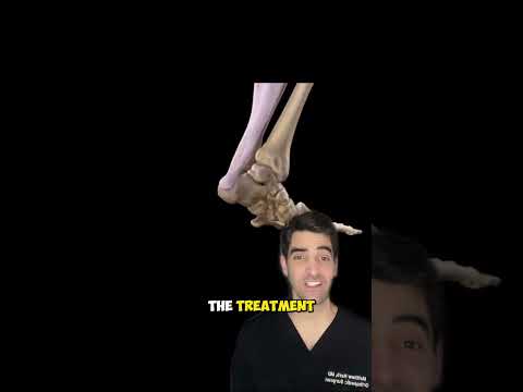 Achilles Tendon Rupture