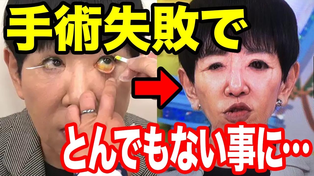和田アキ子目の動画 画像 動画検索 マイルドサイト