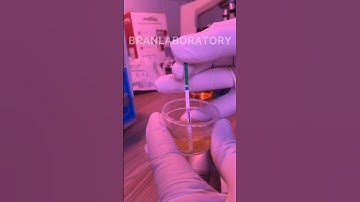 URINE PREGNANCY TEST// simple procedure