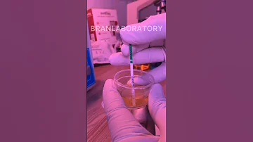 URINE PREGNANCY TEST Simple Procedure 
