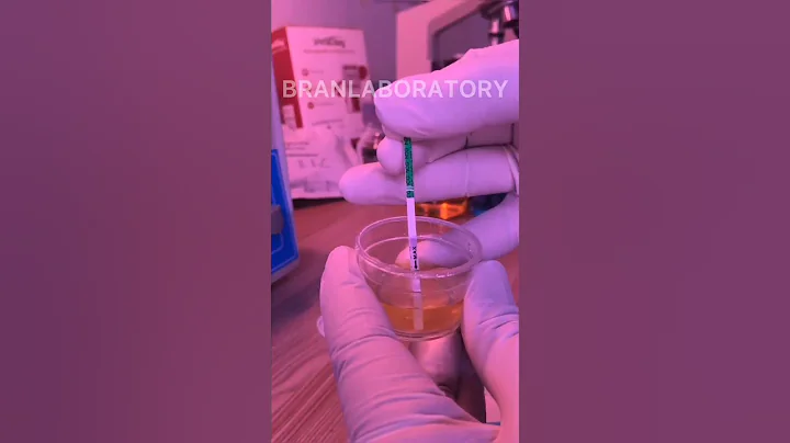 URINE PREGNANCY TEST// simple procedure
