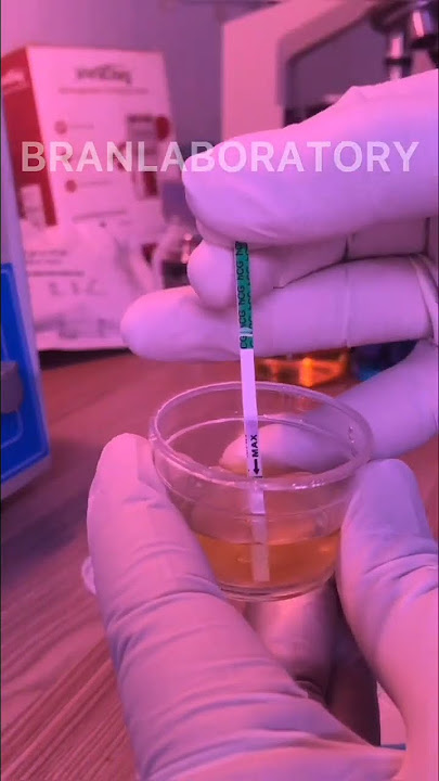 URINE PREGNANCY TEST// simple procedure