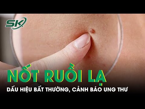 Video: Làm thế nào để điều trị và ngăn ngừa bàn chân của vận động viên (có hình ảnh)