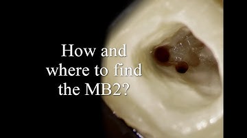 How and where to find the MB2 canals?