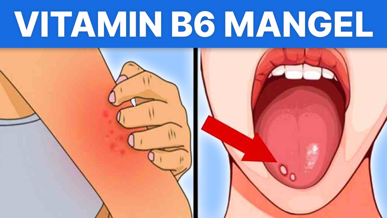 Vitamin B6 Mangel Symptome Frau www.youtube.com