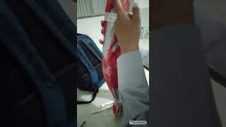 Decoding Upper Limb Model --OSPE / Viva