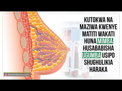 Video: Nini Cha Kufanya Kutoka Kwa Maziwa
