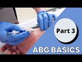 ABG Basics || Part 3 || Respiratory Acidosis