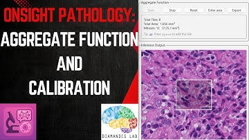 OnSight Pathology: Aggregate Function and Calibration Tutorial