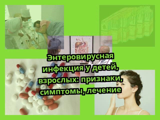 Энтеровирусная инфекция у детей, взрослых: признаки, симптомы, лечение