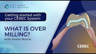 What is Over milling | Getting started with your CEREC System