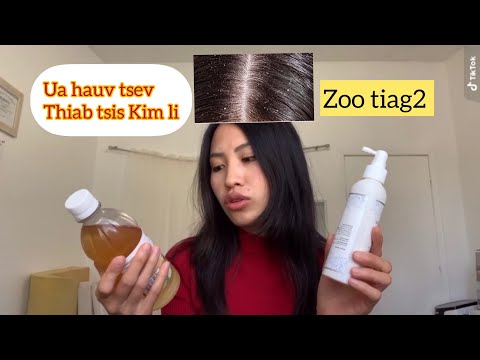 Video: Yuav Tshem Tawm Dandruff Siv Vinegar: 12 Cov Kauj Ruam (nrog Duab)