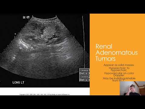 ቪዲዮ: Hemangiosarcoma ወይም Benign Tumor - የቤት እንስሳዎን ለካንሰር ዕጢዎች ማከም