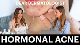 What causes hormonal acne and how to treat it like a dermatologist | Dear Dermatologist