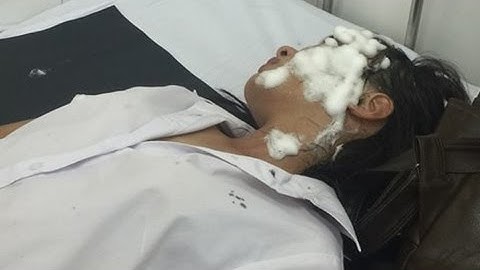 Hai Nữ Sinh Đi Đường Bị Tạt Axit Tại Sài Gòn Có Nguy Cơ Mù Mắt