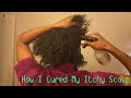 How I cured my itchy scalp naturally l Apple Cider Vinegar rinse for dreadlocks, locs, dreads