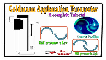 Goldmann Applanation Tonometer - Complete Tutorial.