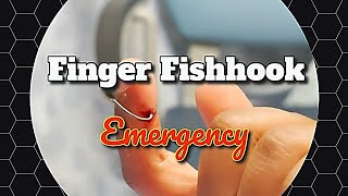 Emergency Medicine Techniques, Equipment List for Removing Fishhooks Lodged  in Patients - Page 4 of 4 - ACEP Now