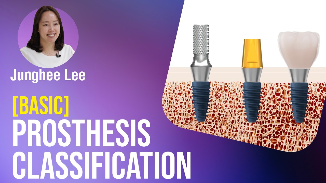 Prosthesis Classification [BASIC] - YouTube