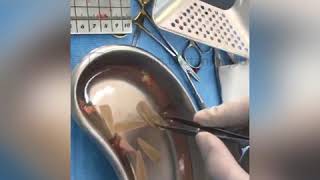 مواد مورد استفاده در جراحی ترمیمی بینی توسط دکتر باستانی نژاد | Materials used in rhinoplasty
