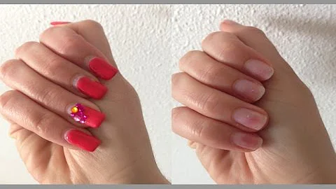 Qui Voir Pour Un Ongle Arrache