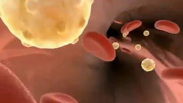 ¿Qué vitamina previene la obstrucción de las arterias?