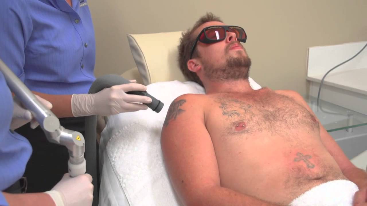 Laser Tattoo Removal Brisbane - YouTube