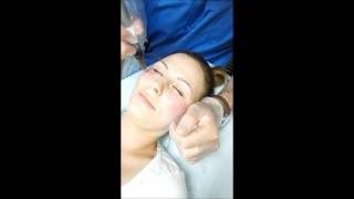 Więcej Niż Osocze Bogatopłytkowe - I-Prf - Komórki Macierzyste Osocze Bogatopłytkowe