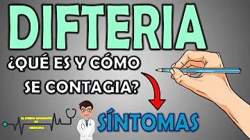 ¿Cuáles son los signos de alarma de la difteria C?