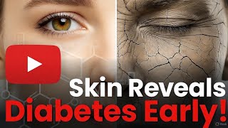 “Your Skin Warns You FIRST! Hidden Diabetes Signs Before Any Blood Test”